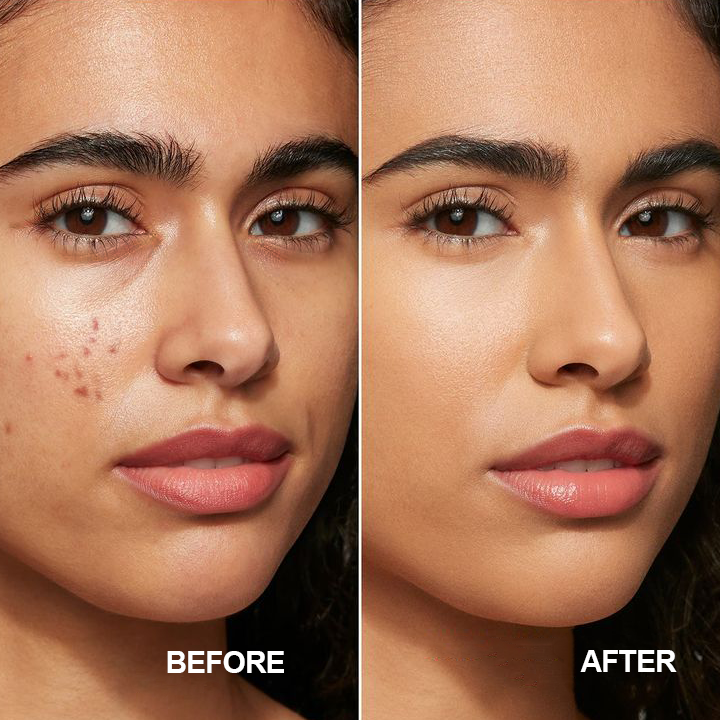 LIMETOW™ Six-Color Concealer Palette