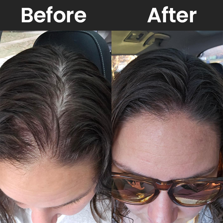 LIMETOW™ Hair Building Fibers