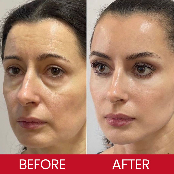 LIMETOW® Retinol Eye Stick✅ for Reduces Fine Lines,Puffiness and Dark Circles🌟