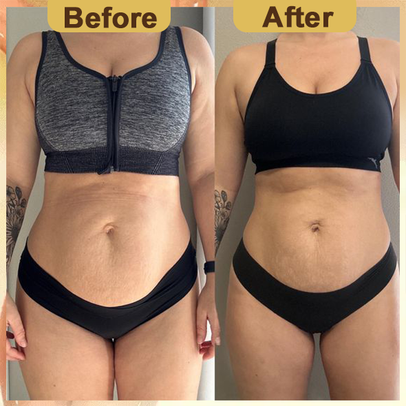🎉2024 New Abdominal Detox Ginger Oil🎉(Limited Time Discount 🔥 Last Day)