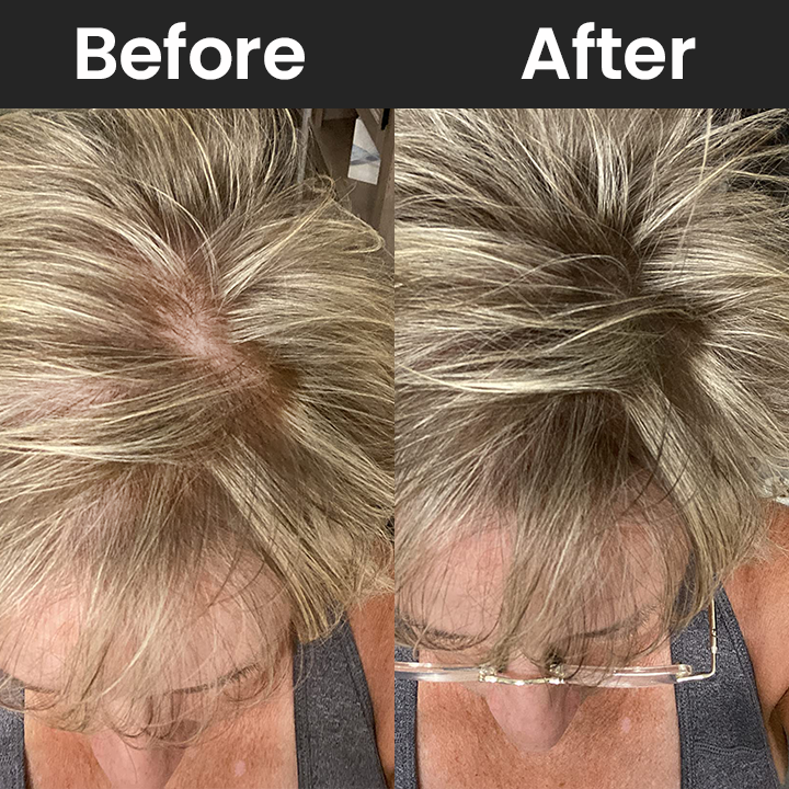 LIMETOW™ Hair Building Fibers