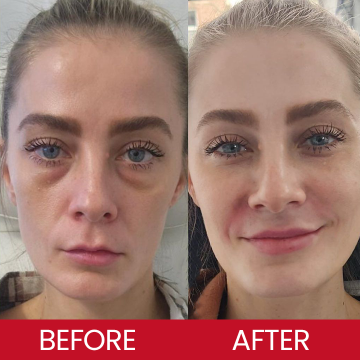 LIMETOW® Retinol Eye Stick✅ for Reduces Fine Lines,Puffiness and Dark Circles🌟