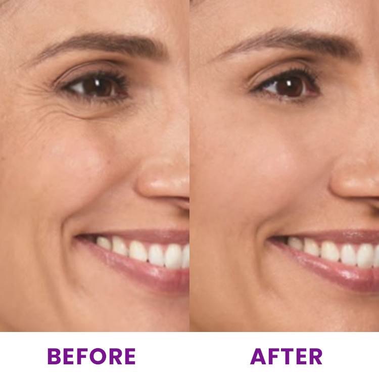 LIMETOW™ Pro-Xylane Rejuvenating Face Serum