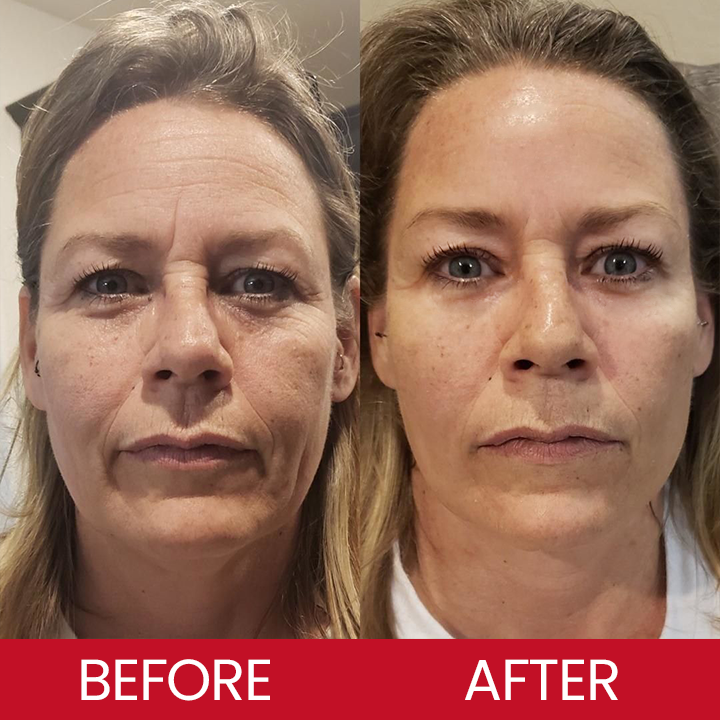 LIMETOW® Retinol Eye Stick✅ for Reduces Fine Lines,Puffiness and Dark Circles🌟