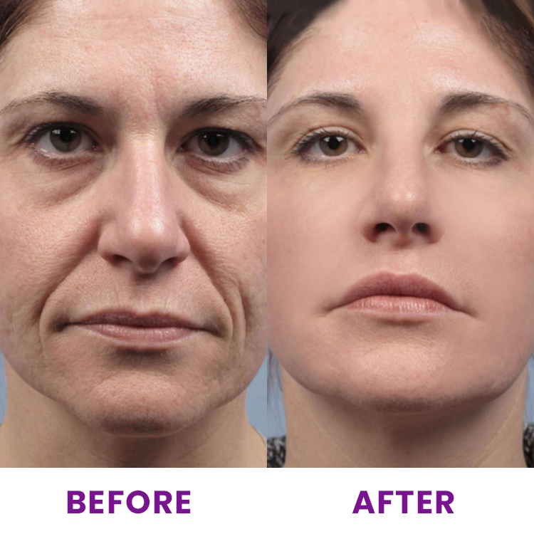 LIMETOW™ Pro-Xylane Rejuvenating Face Serum