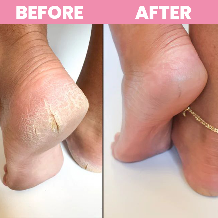 LIMETOW® Shower Foot Scrubber Mat