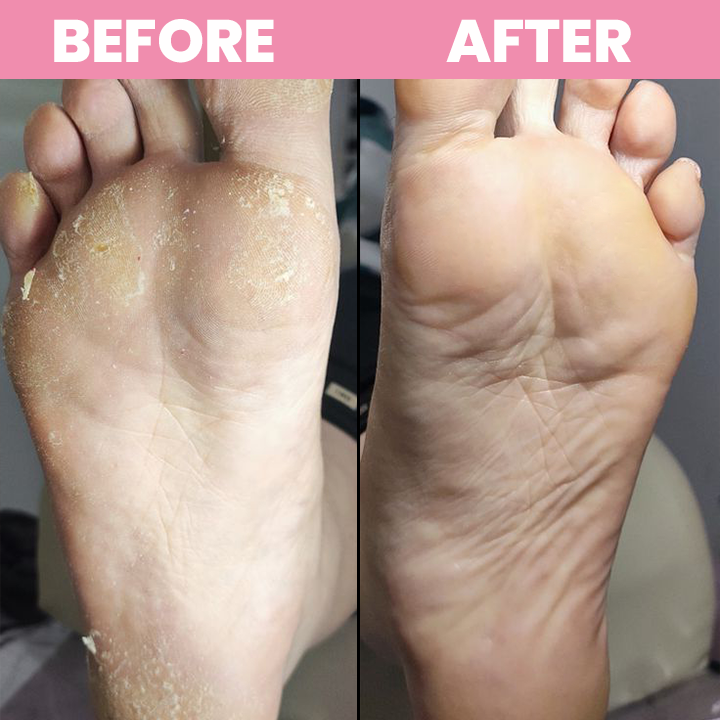 LIMETOW® Shower Foot Scrubber Mat