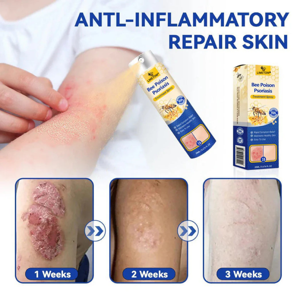 LIMETOW® Bee Venom Psoriasis Treatment Spray