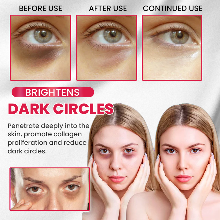 LIMETOW® Retinol Eye Stick✅ for Reduces Fine Lines,Puffiness and Dark Circles🌟