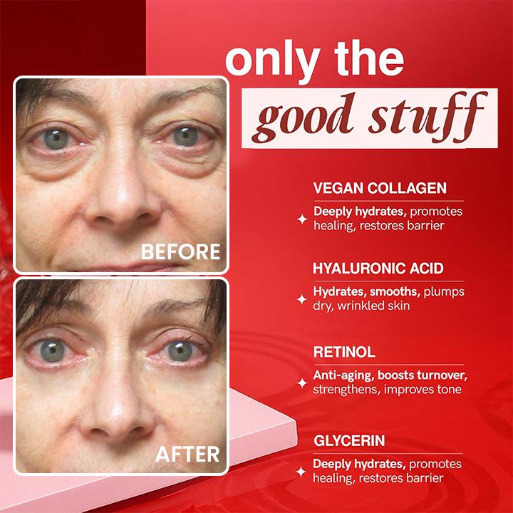 LIMETOW® Retinol Eye Stick✅ for Reduces Fine Lines,Puffiness and Dark Circles🌟