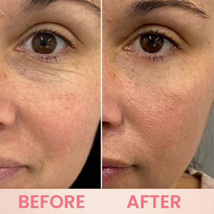 LIMETOW™ Rosehip Eye Balm