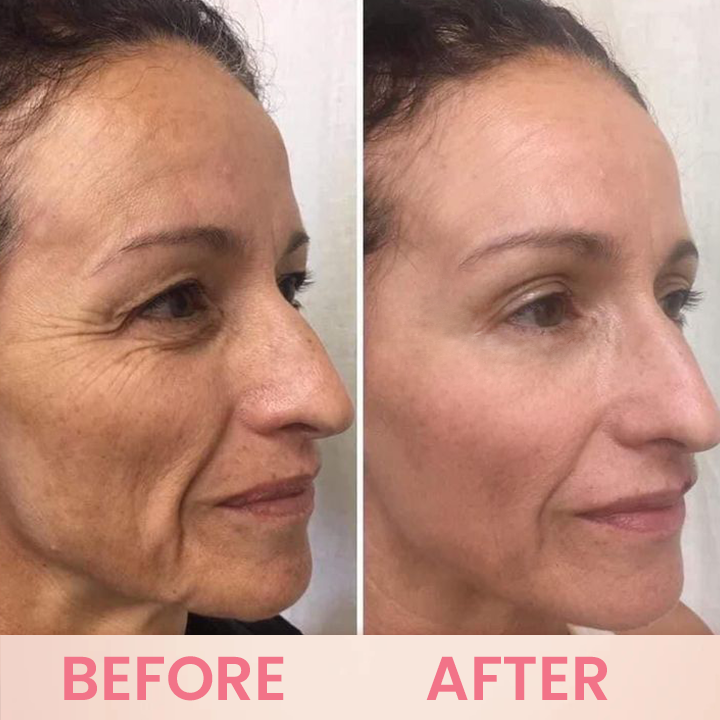 LIMETOW™ Rosehip Eye Balm