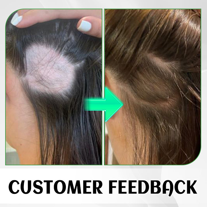 LIMETOW™ FolliHerb Hair Growth Spray