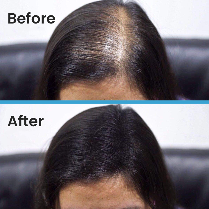 LIMETOW™ Hair Building Fibers