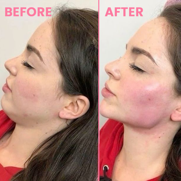 LIMETOW™ Face Lifting Suction Trainer