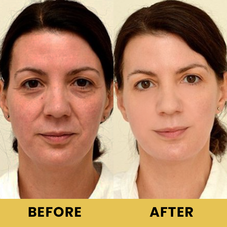LIMETOW™ Advanced Snail 96 Mucin Power Essence