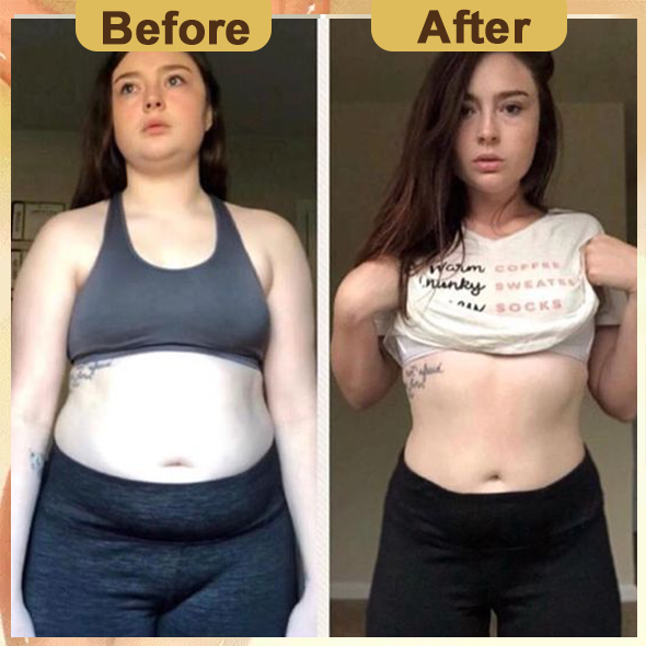 🎉2024 New Abdominal Detox Ginger Oil🎉(Limited Time Discount 🔥 Last Day)