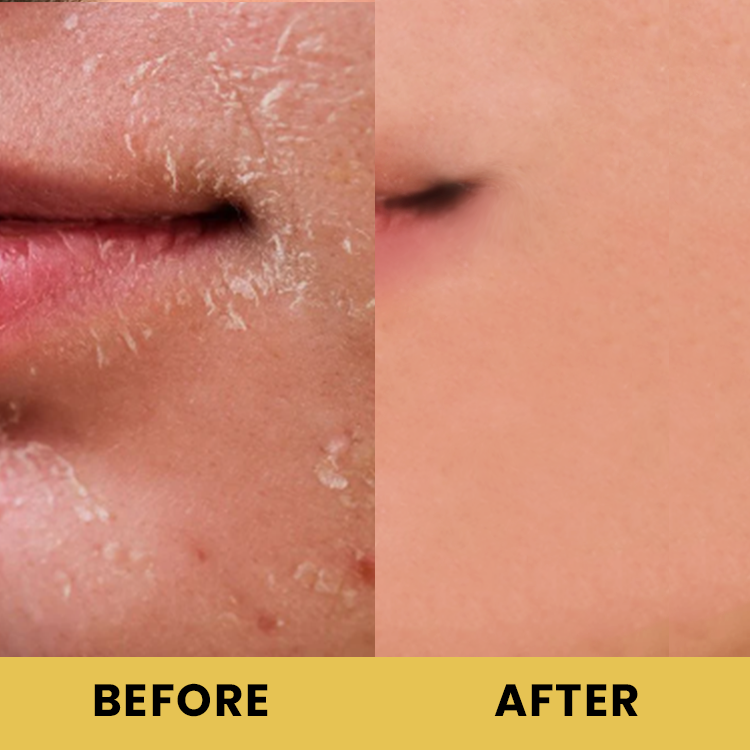 LIMETOW™ Advanced Snail 96 Mucin Power Essence