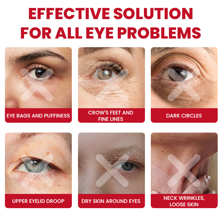 LIMETOW® Retinol Eye Stick✅ for Reduces Fine Lines,Puffiness and Dark Circles🌟