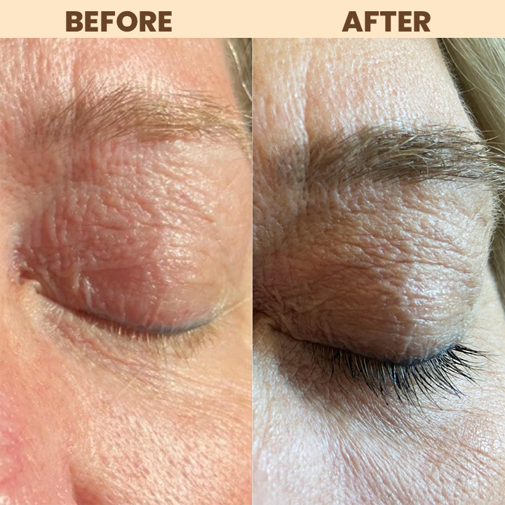 LIMETOW™ Eyelash Nutrient Solution