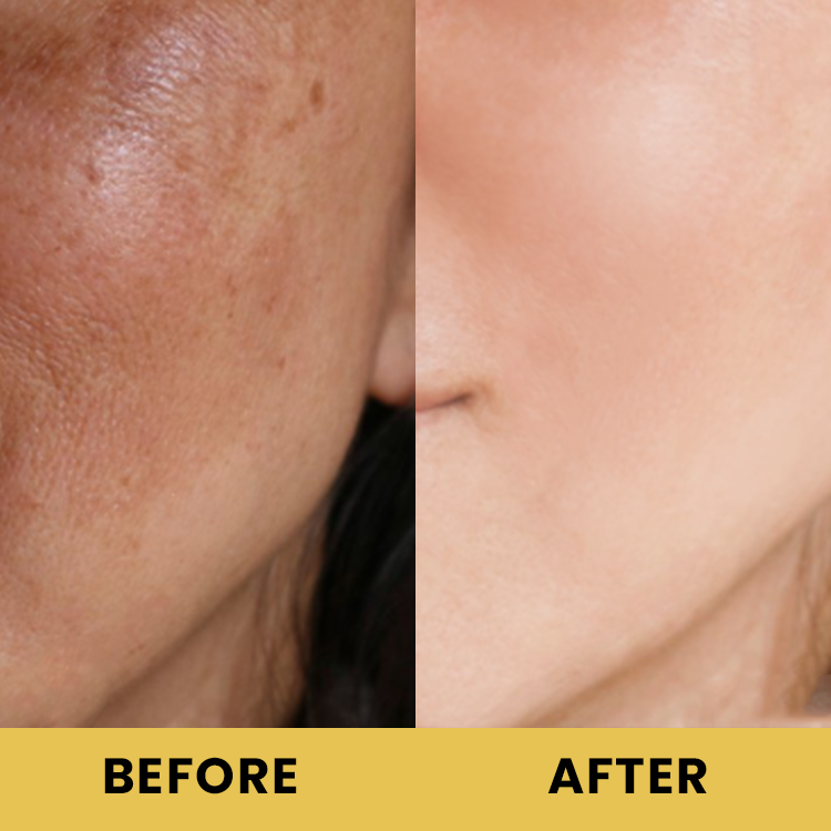 LIMETOW™ Advanced Snail 96 Mucin Power Essence