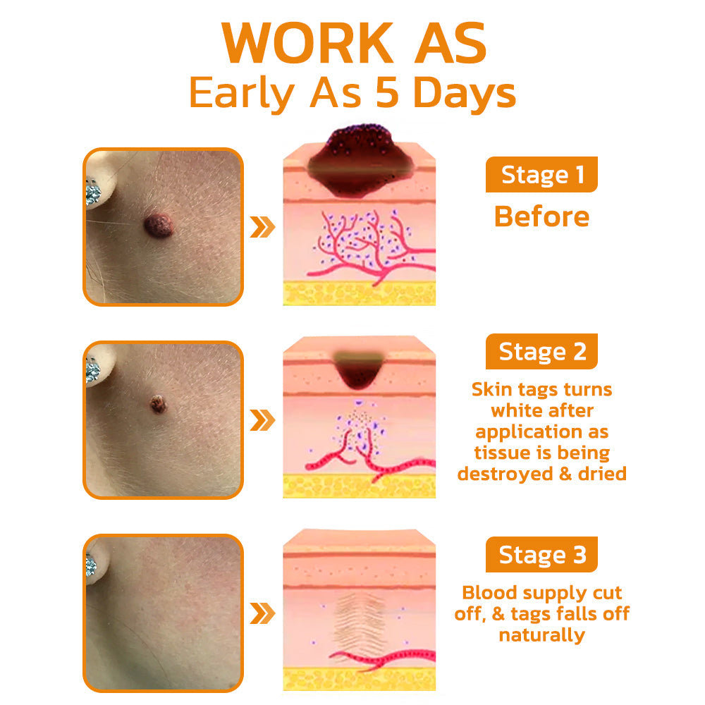 LIMETOW™ DeleTag Bee Venom Treatment Gel