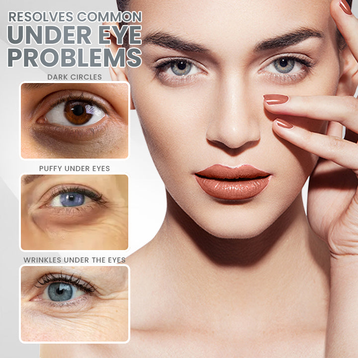 ✨Last Day Discount 80% OFF🌟LIMETOW™ Eyebag Cream