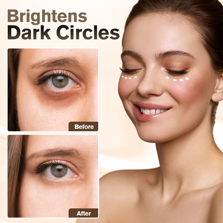 LIMETOW™ Instant Eye Cream Tightener