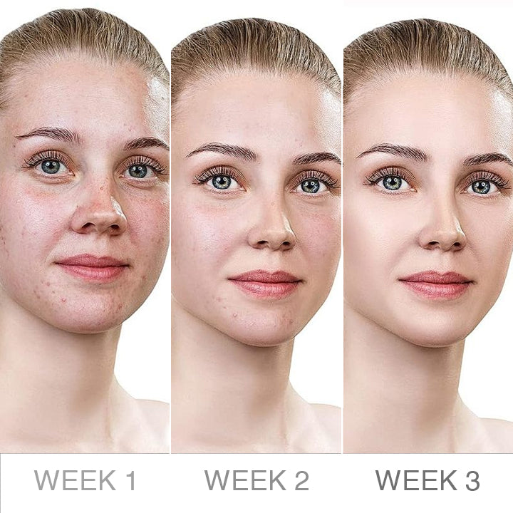 LIMETOW™ Truffle Biome Skin Cream
