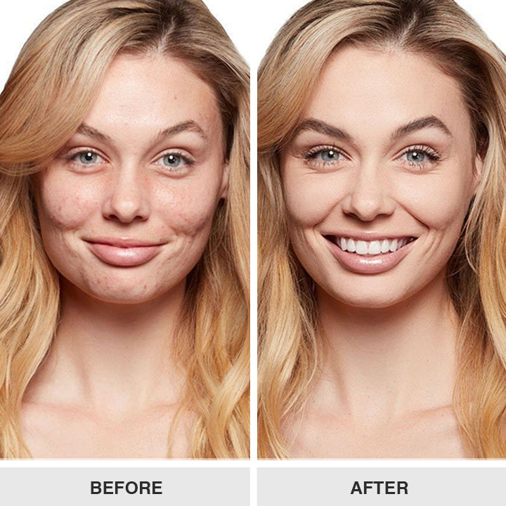 LIMETOW™ Truffle Biome Skin Cream