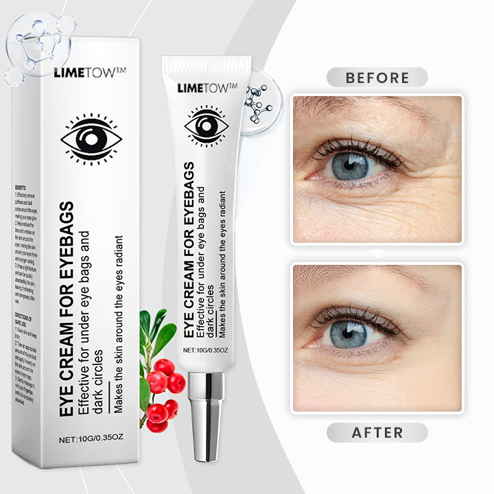 ✨Last Day Discount 80% OFF🌟LIMETOW™ Eyebag Cream