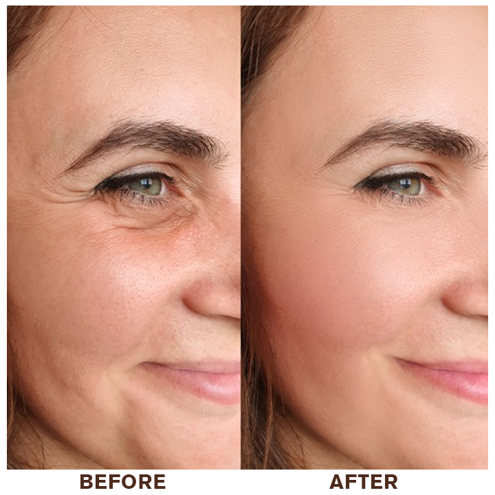 LIMETOW™ Instant Eye Cream Tightener