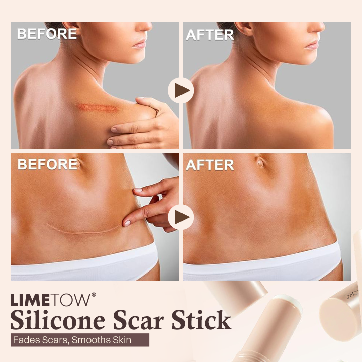 LIMETOW® Silicone Scar Stick