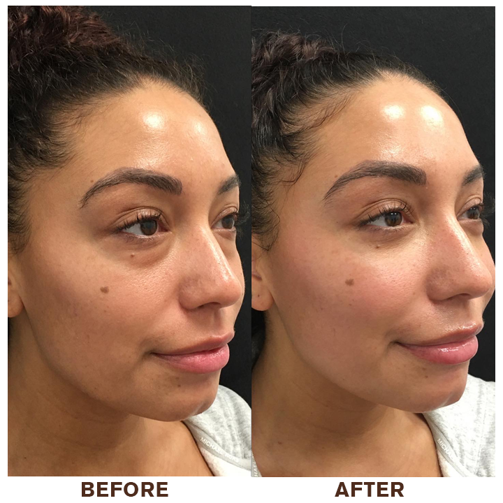 LIMETOW™ Instant Eye Cream Tightener