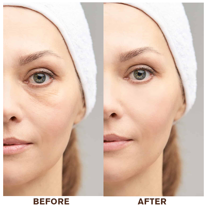 LIMETOW™ Instant Eye Cream Tightener
