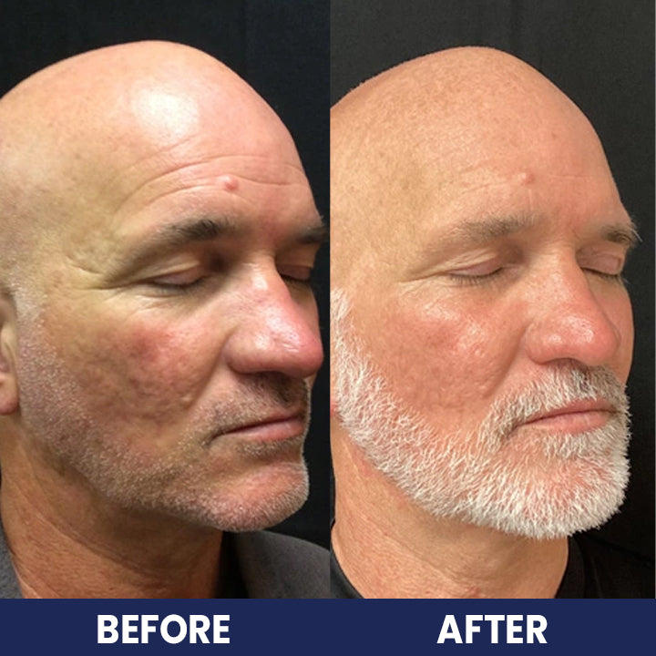 LIMETOW™ Collagen For Men