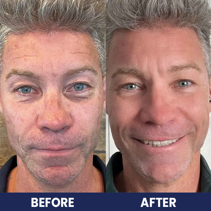 LIMETOW™ Collagen For Men