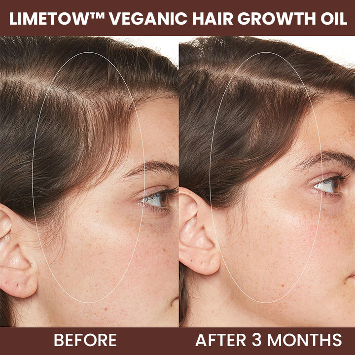 LIMETOW™ Veganic Hair Growth Oil