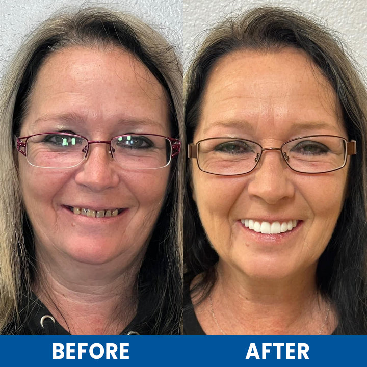 LIMETOW™ Teeth Whitening Essence