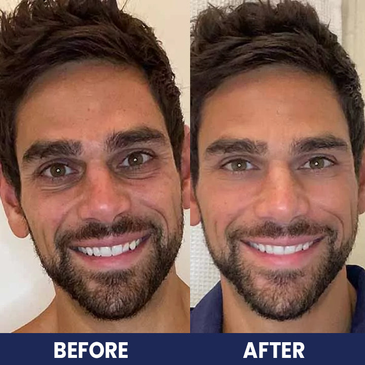 LIMETOW™ Collagen For Men