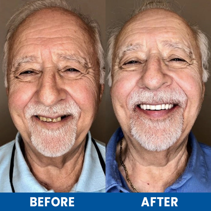LIMETOW™ Teeth Whitening Essence