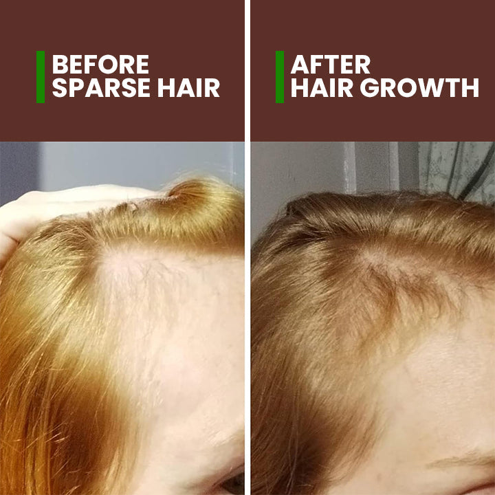 LIMETOW™ Veganic Hair Growth Oil