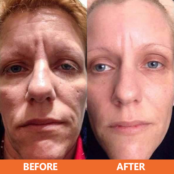 🔥HOT SALE🔥 ✨✨LIMETOW™ Vitamin C Anti-Aging Serum✨✨