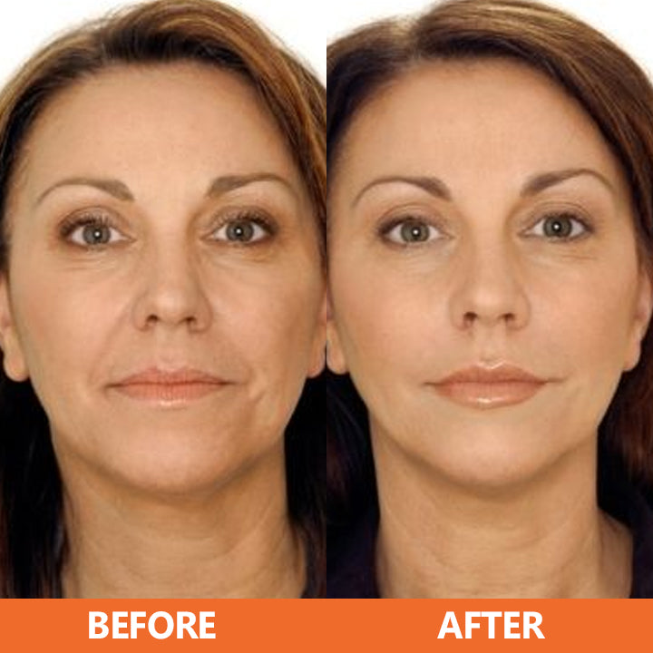 🔥HOT SALE🔥 ✨✨LIMETOW™ Vitamin C Anti-Aging Serum✨✨