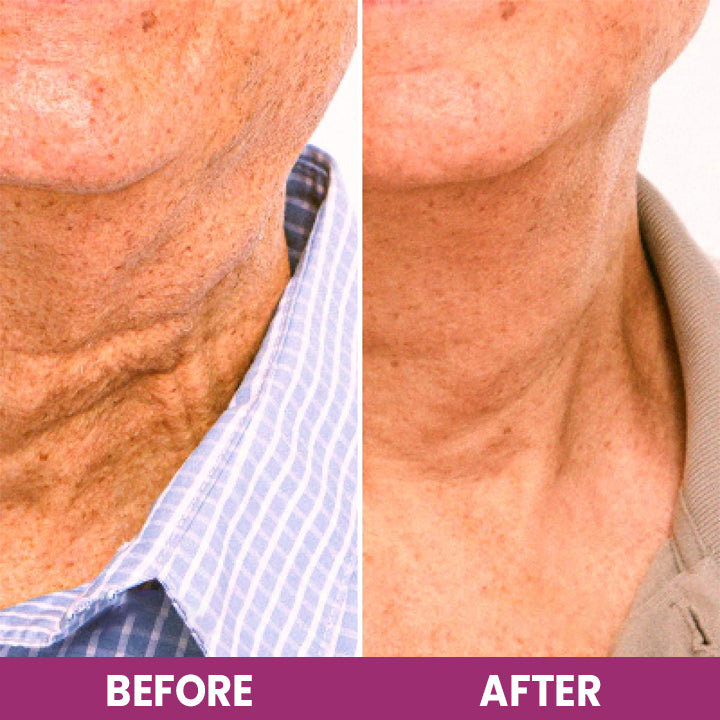 LIMETOW™ Hydrolyzed Collagen Neck Cream