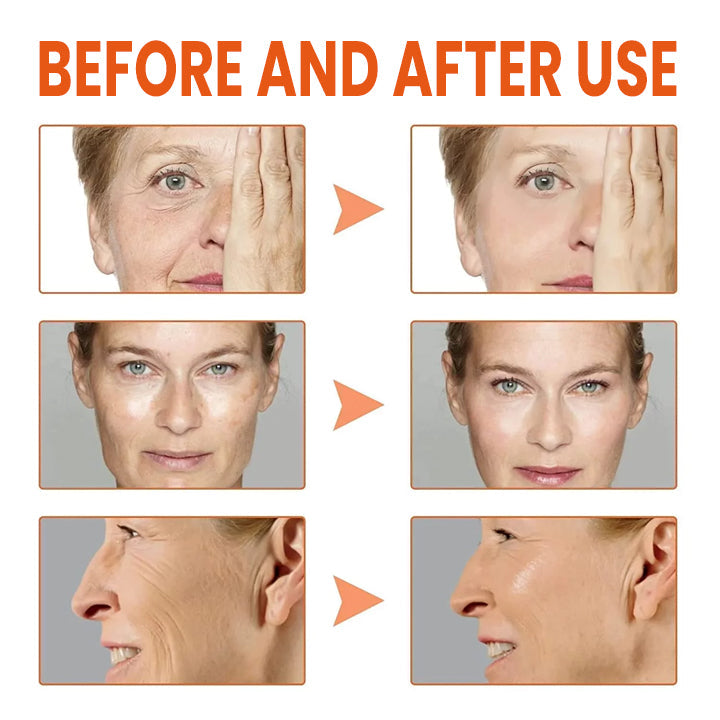 🔥HOT SALE🔥 ✨✨LIMETOW™ Vitamin C Anti-Aging Serum✨✨