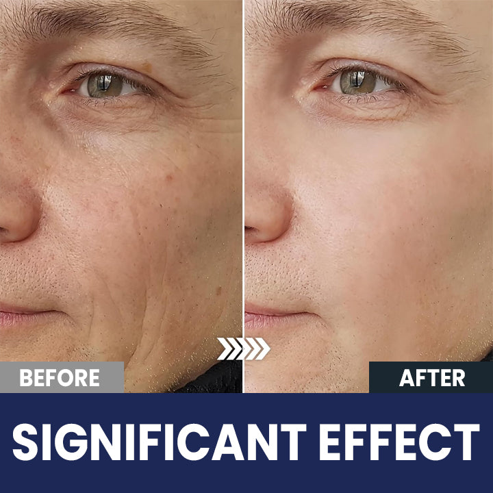 LIMETOW™ Collagen For Men