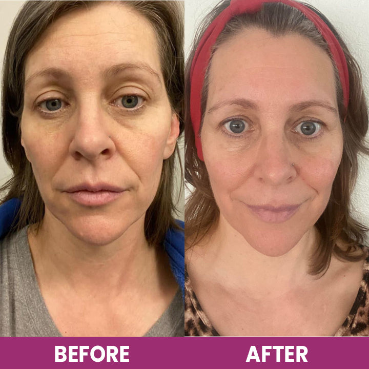 LIMETOW™ Hydrolyzed Collagen Neck Cream