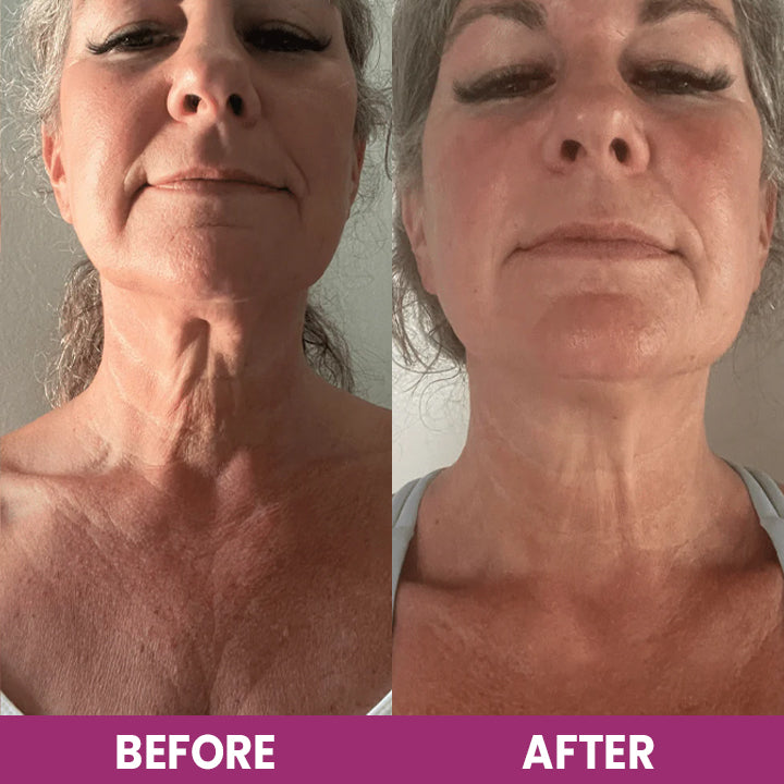 LIMETOW™ Hydrolyzed Collagen Neck Cream