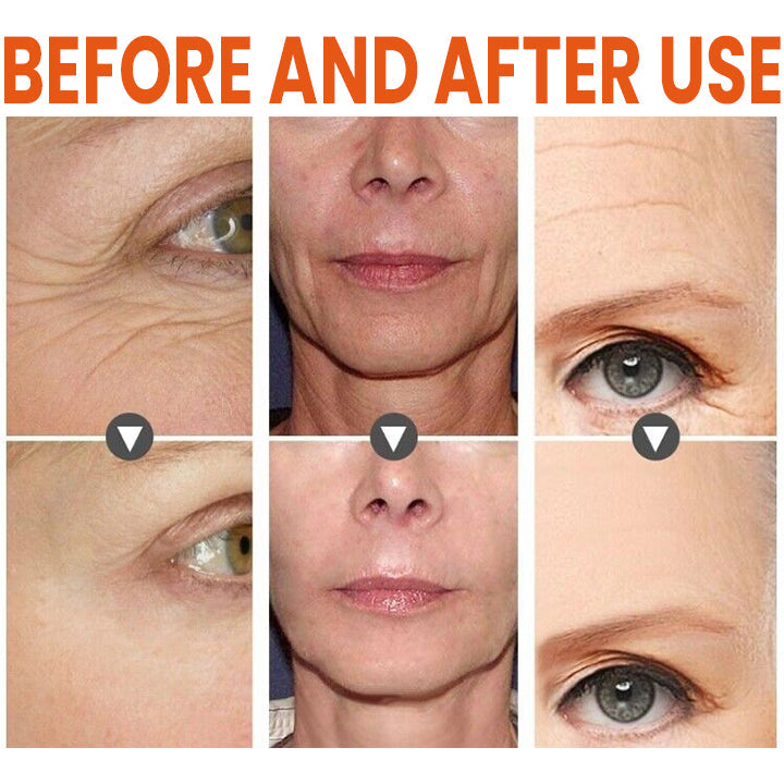 🔥HOT SALE🔥 ✨✨LIMETOW™ Vitamin C Anti-Aging Serum✨✨